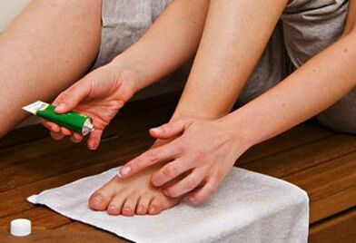 Applicare un unguento per trattare il fungo dell'unghia del piede