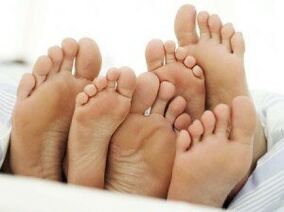 piedi sani dopo il trattamento fungino tra le dita